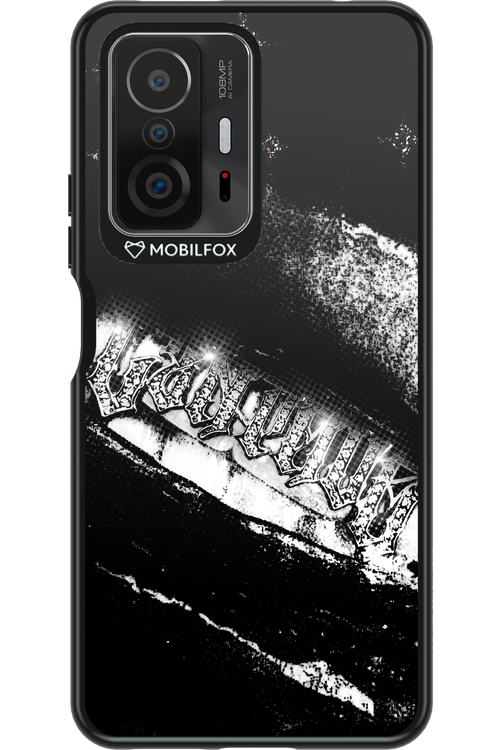 Grillz Black Centaur 2.0 - Xiaomi Mi 11T