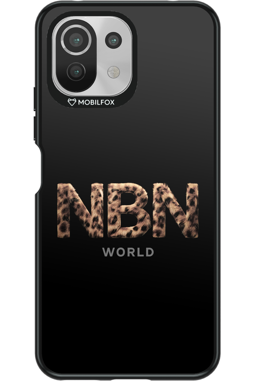 Black 2.0 - Xiaomi Mi 11 Lite (2021)