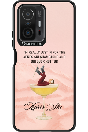 Champagne Tub - Xiaomi Mi 11T