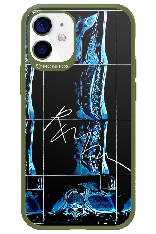 RMN Scolioza 2.0 - Apple iPhone 12 Mini