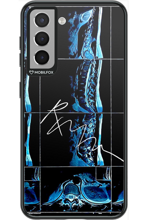 RMN Scolioza 2.0 - Samsung Galaxy S21