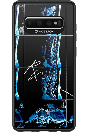 RMN Scolioza 2.0 - Samsung Galaxy S10+