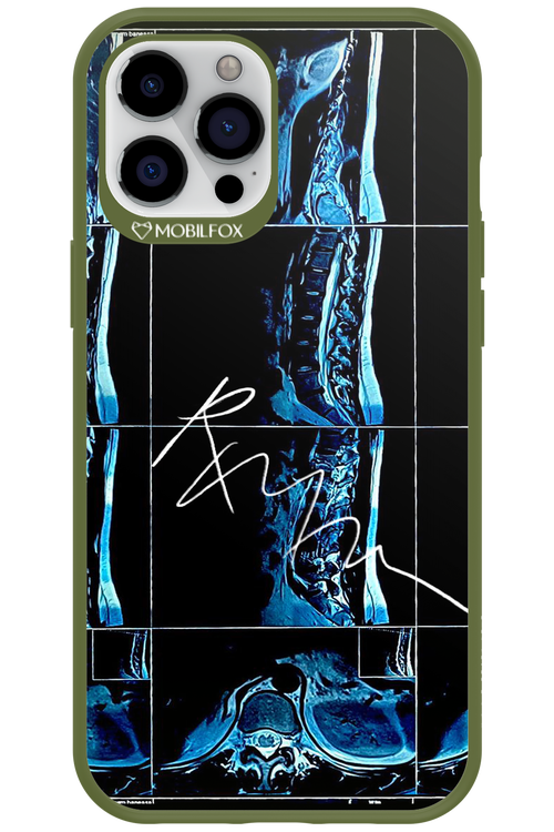 RMN Scolioza 2.0 - Apple iPhone 12 Pro Max