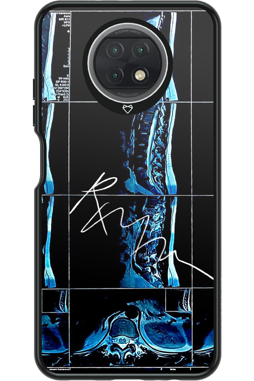 RMN Scolioza 2.0 - Xiaomi Redmi Note 9T 5G
