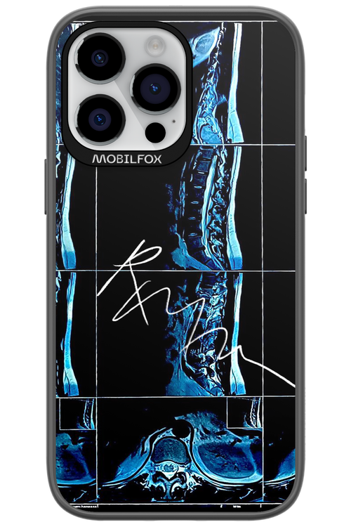 RMN Scolioza 2.0 - Apple iPhone 14 Pro Max