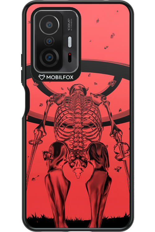 RMN Cover 2.0 - Xiaomi Mi 11T