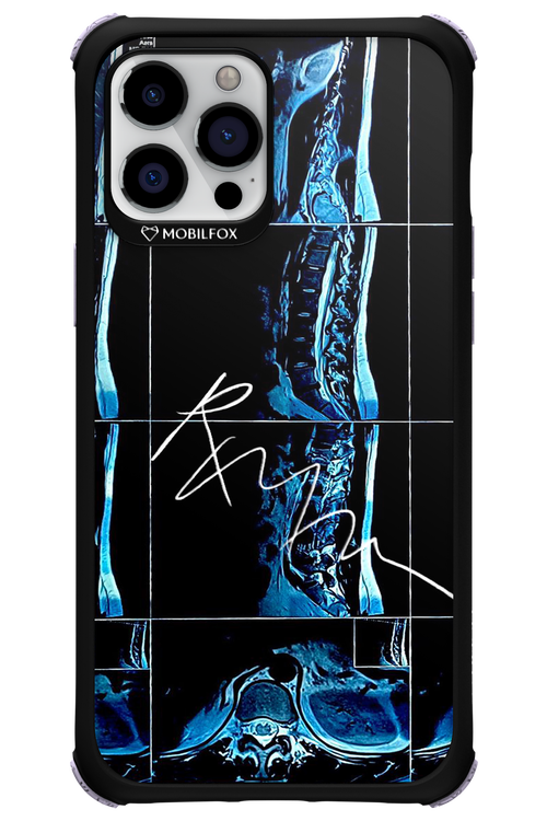 RMN Scolioza 2.0 - Apple iPhone 12 Pro Max