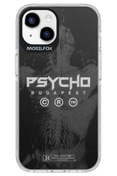 X-Ray - Apple iPhone 14