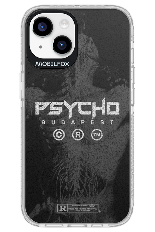 X-Ray - Apple iPhone 14