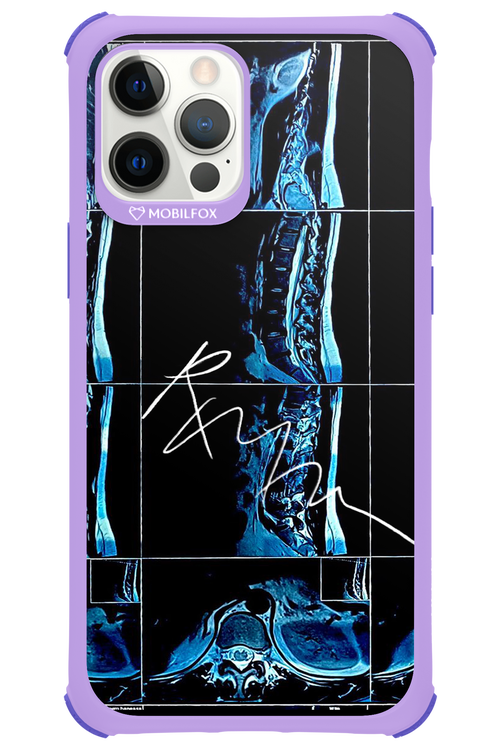 RMN Scolioza 2.0 - Apple iPhone 12 Pro Max