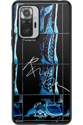 RMN Scolioza 2.0 - Xiaomi Redmi Note 10S