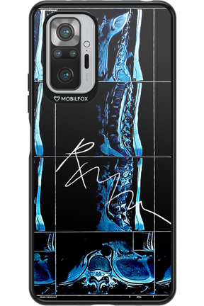 RMN Scolioza 2.0 - Xiaomi Redmi Note 10S