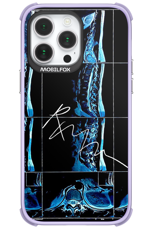 RMN Scolioza 2.0 - Apple iPhone 14 Pro Max