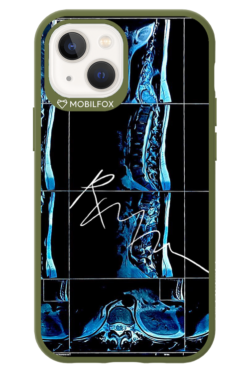 RMN Scolioza 2.0 - Apple iPhone 13 Mini