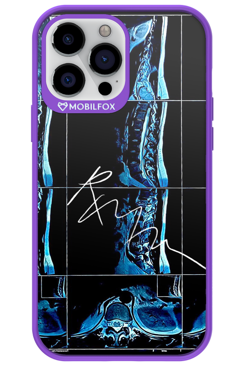 RMN Scolioza 2.0 - Apple iPhone 13 Pro Max