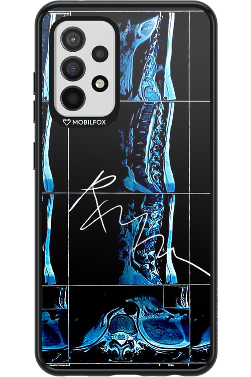 RMN Scolioza 2.0 - Samsung Galaxy A52 / A52 5G / A52s