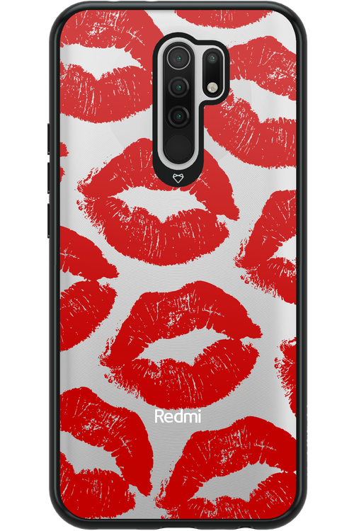 Lipss - Xiaomi Redmi 9