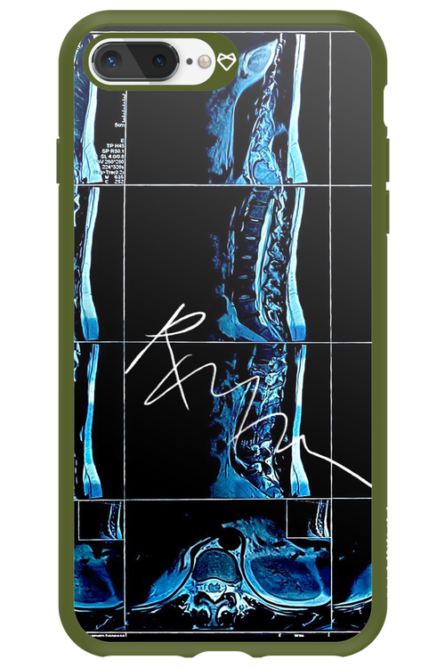 RMN Scolioza 2.0 - Apple iPhone 7 Plus
