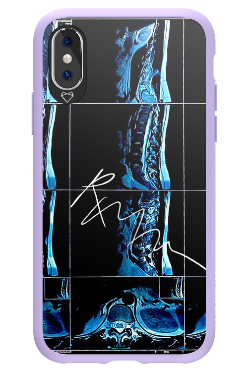 RMN Scolioza 2.0 - Apple iPhone XS