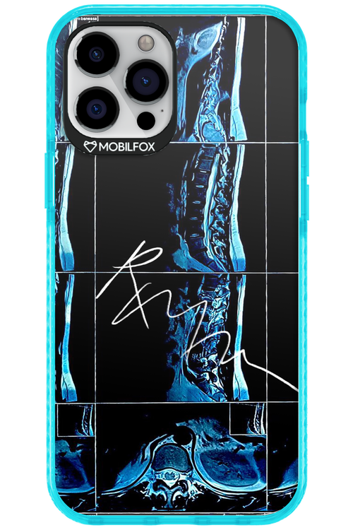 RMN Scolioza 2.0 - Apple iPhone 12 Pro Max