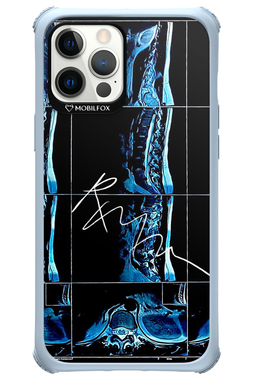 RMN Scolioza 2.0 - Apple iPhone 12 Pro Max