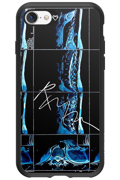 RMN Scolioza 2.0 - Apple iPhone 8