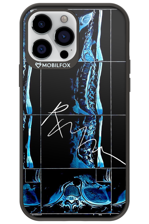 RMN Scolioza 2.0 - Apple iPhone 13 Pro Max