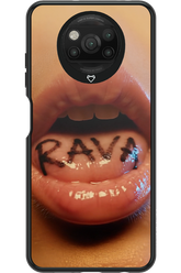 Rava Kiss - Xiaomi Poco X3 NFC