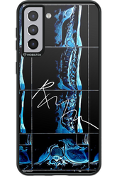 RMN Scolioza 2.0 - Samsung Galaxy S21+