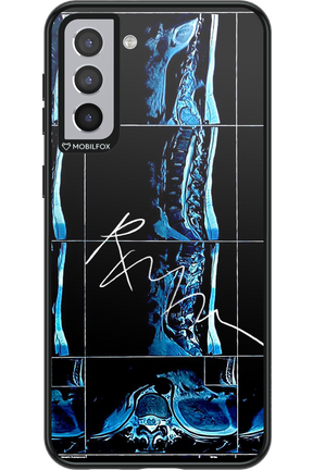 RMN Scolioza 2.0 - Samsung Galaxy S21+