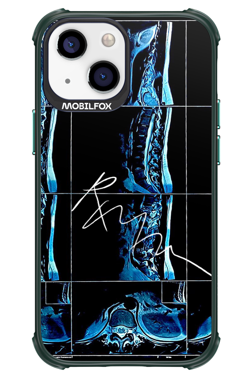RMN Scolioza 2.0 - Apple iPhone 13 Mini