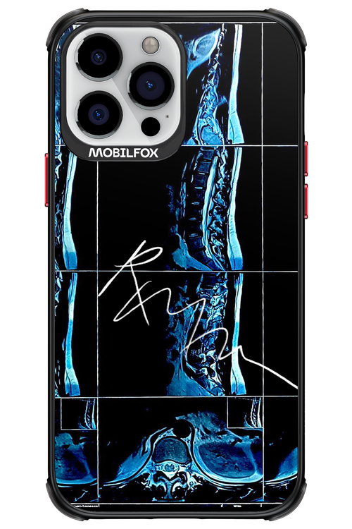 RMN Scolioza 2.0 - Apple iPhone 13 Pro Max