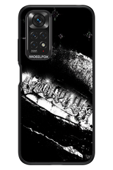 Grillz Black Centaur 2.0 - Xiaomi Redmi Note 11/11S 4G