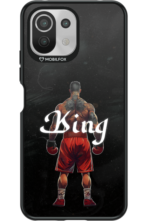 King - Xiaomi Mi 11 Lite (2021)