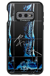 RMN Scolioza 2.0 - Samsung Galaxy S10e