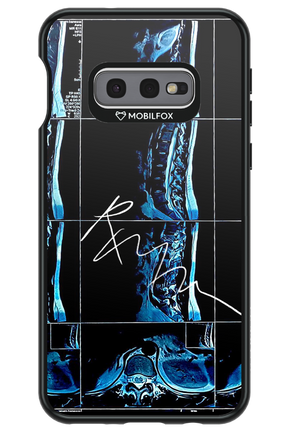 RMN Scolioza 2.0 - Samsung Galaxy S10e