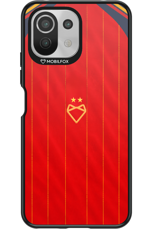 Spain Gold 2.0 - Xiaomi Mi 11 Lite (2021)