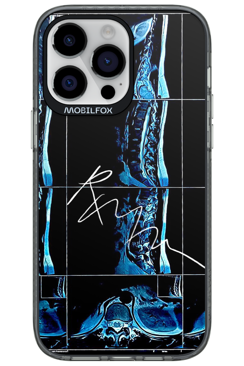 RMN Scolioza 2.0 - Apple iPhone 14 Pro Max