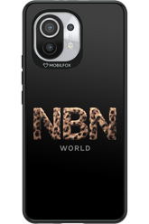 Black 2.0 - Xiaomi Mi 11 5G