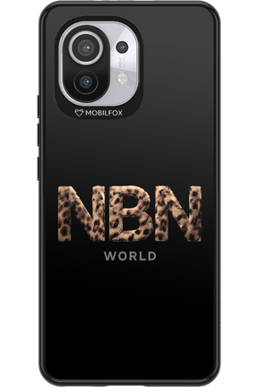 Black 2.0 - Xiaomi Mi 11 5G