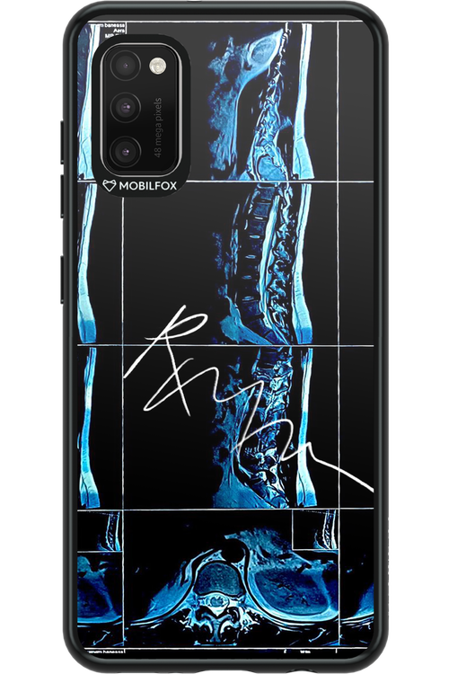 RMN Scolioza 2.0 - Samsung Galaxy A41